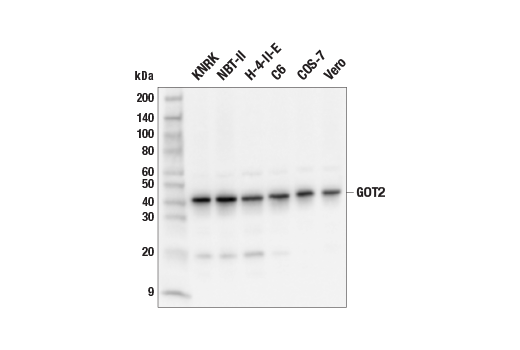 Western Blotting Image 3: GOT2 Antibody
