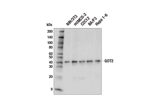 Western Blotting Image 2: GOT2 Antibody