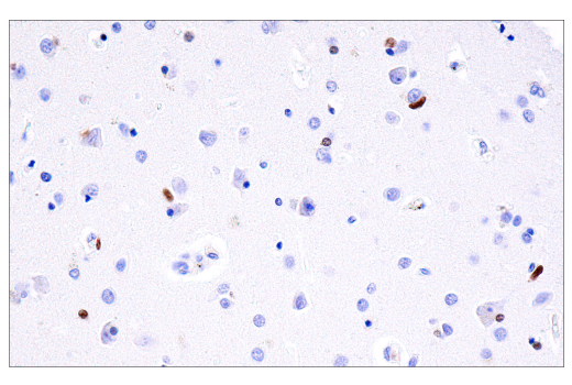Immunohistochemistry Image 2: Olig2 (E6G6Q) XP® Rabbit mAb (BSA and Azide Free)