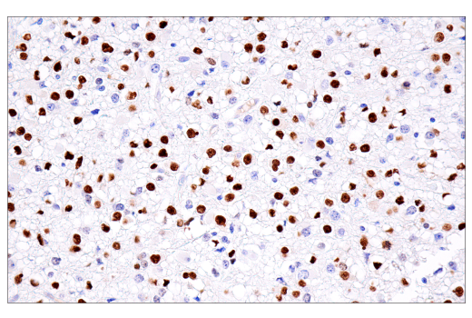 Immunohistochemistry Image 1: Olig2 (E6G6Q) XP® Rabbit mAb (BSA and Azide Free)
