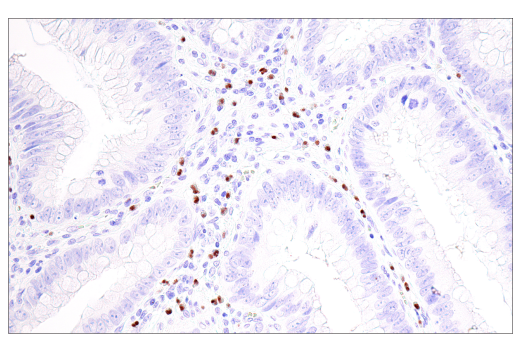 Immunohistochemistry Image 4: Olig2 (E6G6Q) XP® Rabbit mAb (BSA and Azide Free)