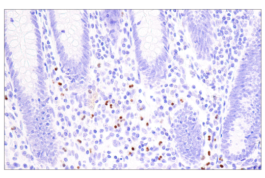 Immunohistochemistry Image 3: Olig2 (E6G6Q) XP® Rabbit mAb (BSA and Azide Free)