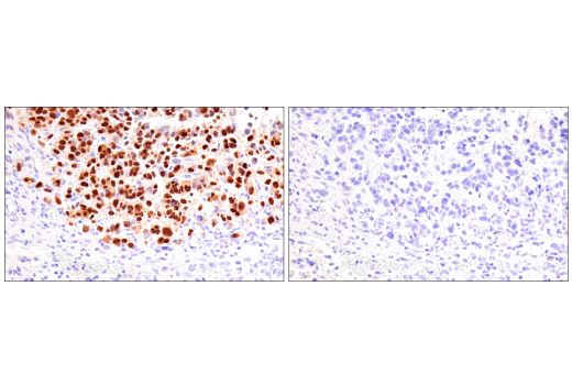 Immunohistochemistry Image 7: Olig2 (E6G6Q) XP® Rabbit mAb (BSA and Azide Free)
