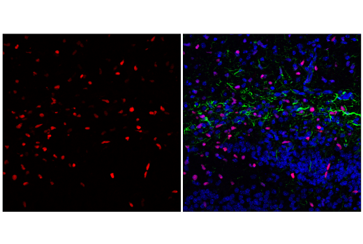 Immunofluorescence Image 1: Olig2 (E6G6Q) XP® Rabbit mAb (BSA and Azide Free)