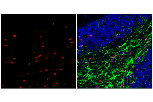 Immunofluorescence Image 2: Olig2 (E6G6Q) XP® Rabbit mAb (BSA and Azide Free)