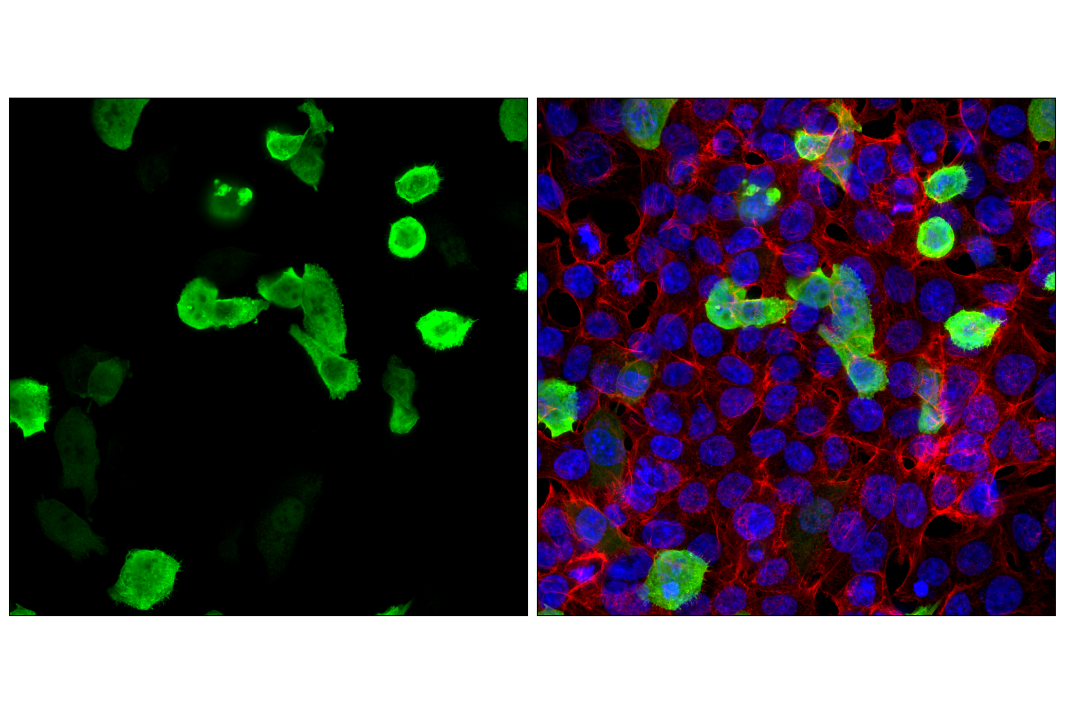 Immunofluorescence Image 1: Glu-Glu Tag (F3Z5J) Rabbit mAb