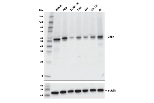  Image 7: PROTAC E3 Ligase Profiling Antibody Sampler Kit