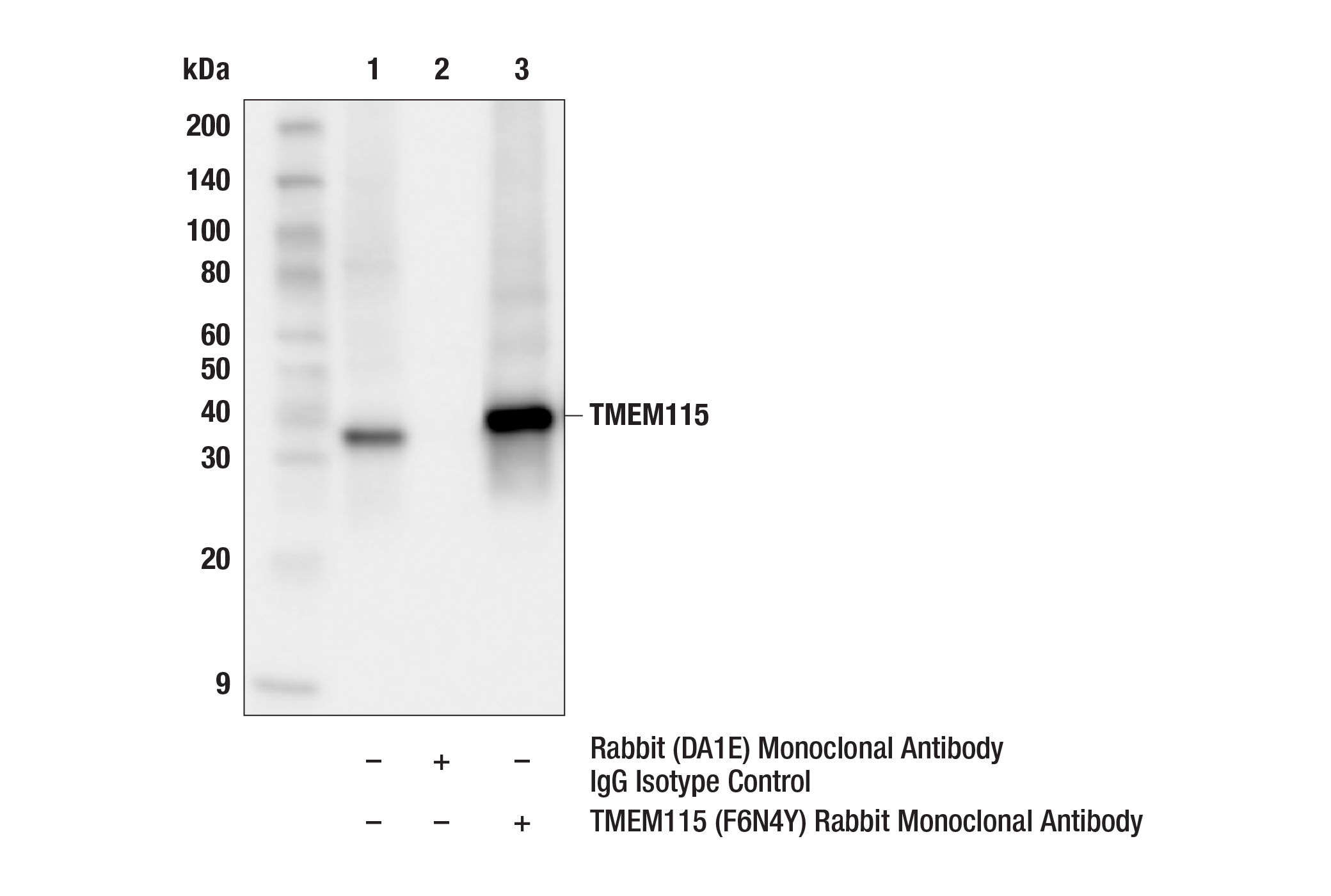 TMEM115: Golgi Marker