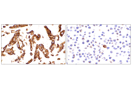 Immunohistochemistry Image 1: Glut1 (IHC404) Mouse mAb