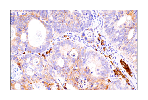 Immunohistochemistry Image 2: Glut1 (IHC404) Mouse mAb