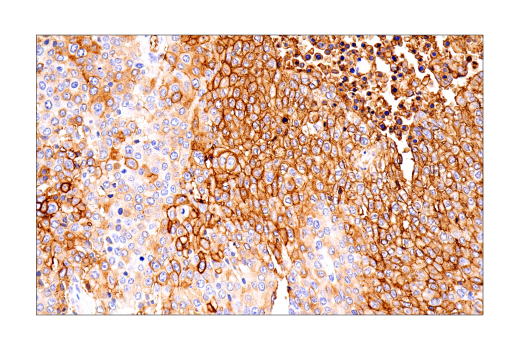 Immunohistochemistry Image 3: Glut1 (IHC404) Mouse mAb