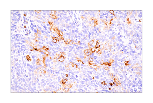 Immunohistochemistry Image 4: Glut1 (IHC404) Mouse mAb