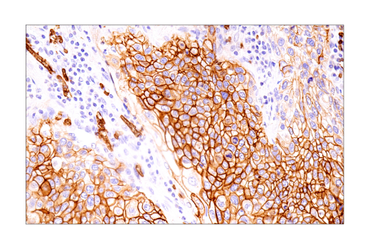 Immunohistochemistry Image 5: Glut1 (IHC404) Mouse mAb