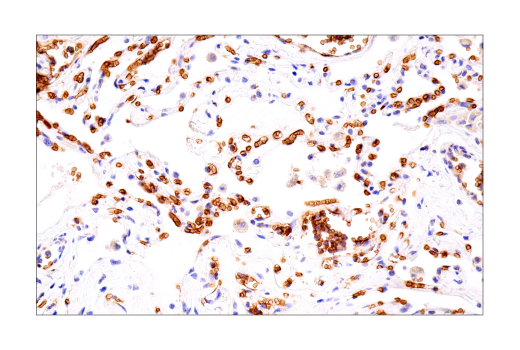 Immunohistochemistry Image 7: Glut1 (IHC404) Mouse mAb