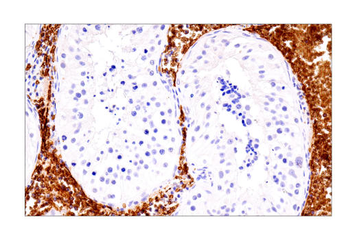Immunohistochemistry Image 10: Glut1 (IHC404) Mouse mAb