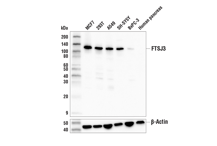 Western Blotting Image 1: FTSJ3 Antibody