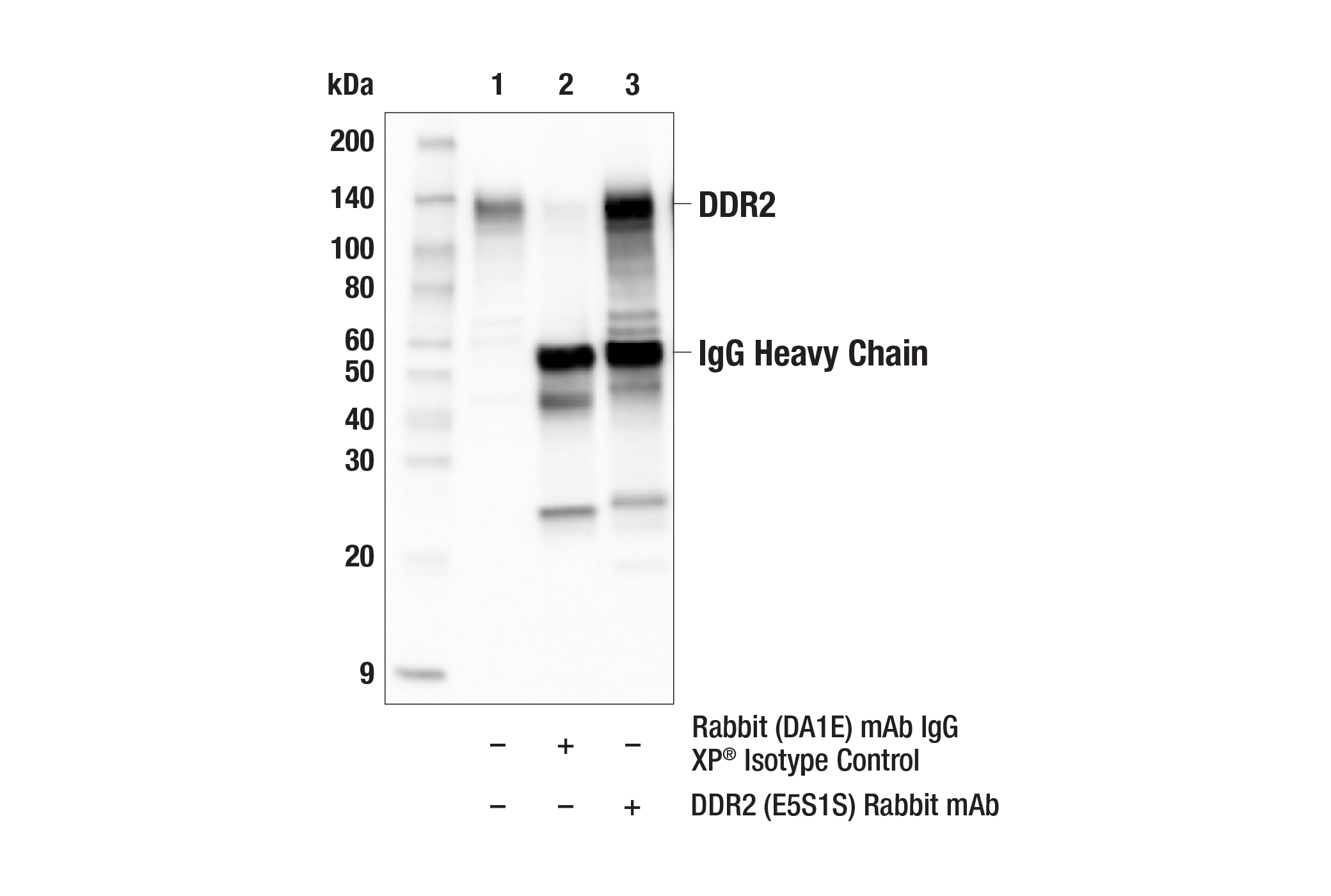 Immunoprecipitation Image 1: DDR2 (E5S1S) Rabbit mAb