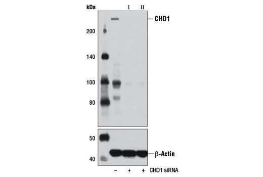  Image 1: SignalSilence® CHD1 siRNA II