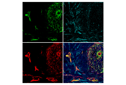 Immunofluorescence Image 1: COL1A1 (E8F4L) XP® Rabbit mAb