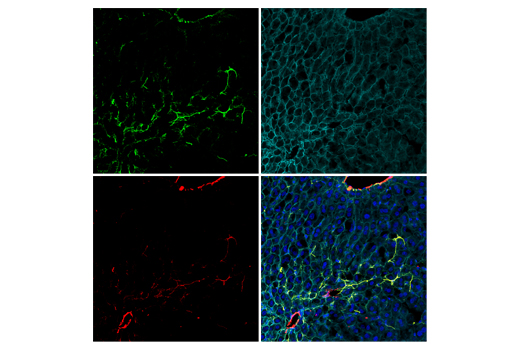 Immunofluorescence Image 3: COL1A1 (E8F4L) XP® Rabbit mAb