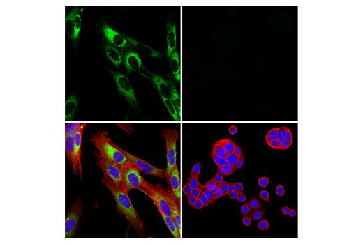 Immunofluorescence Image 4: COL1A1 (E8F4L) XP® Rabbit mAb