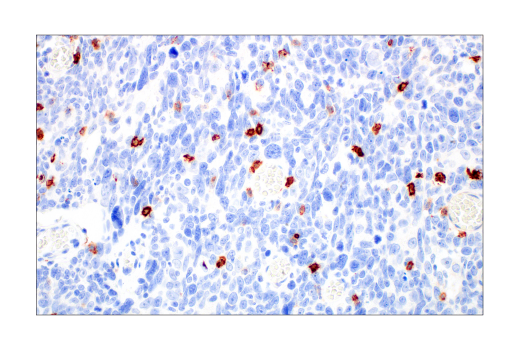 Immunohistochemistry Image 1: CD57 (HNK-1) Mouse mAb
