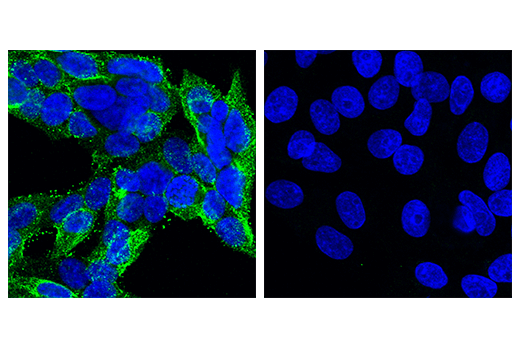 Immunofluorescence Image 1: CD57 (HNK-1) Mouse mAb