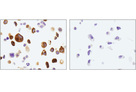 Immunohistochemistry Image 2: TFF1/pS2 (D2Y1J) Rabbit mAb (BSA and Azide Free)