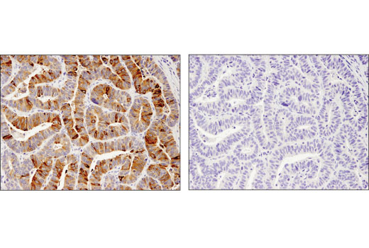 Immunohistochemistry Image 3: TFF1/pS2 (D2Y1J) Rabbit mAb (BSA and Azide Free)