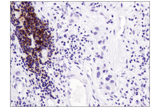 Immunohistochemistry Image 3: CXCR5 (D6L3C) Rabbit mAb (IHC Specific)