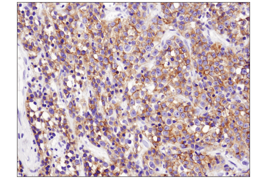 Immunohistochemistry Image 1: CXCR5 (D6L3C) Rabbit mAb (IHC Specific)