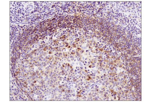 Immunohistochemistry Image 2: CXCR5 (D6L3C) Rabbit mAb (IHC Specific)