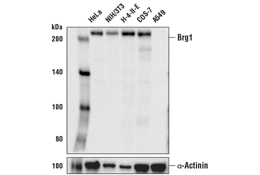  Image 11: BAF Complex IHC Antibody Sampler Kit