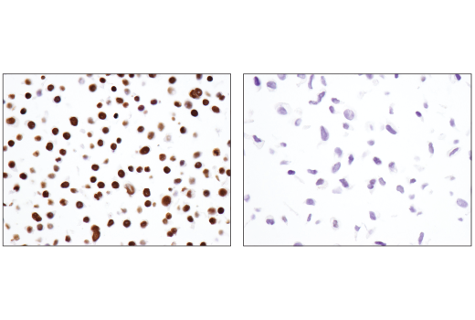 Immunohistochemistry Image 3: Brg1 (E8V5B) Mouse mAb