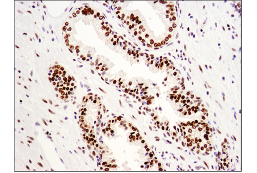 Immunohistochemistry Image 4: Brg1 (E8V5B) Mouse mAb