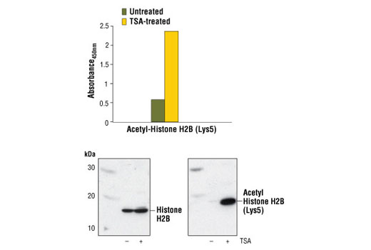  Image 2: PathScan® Acetyl-Histone H2B (Lys5) Sandwich ELISA Kit