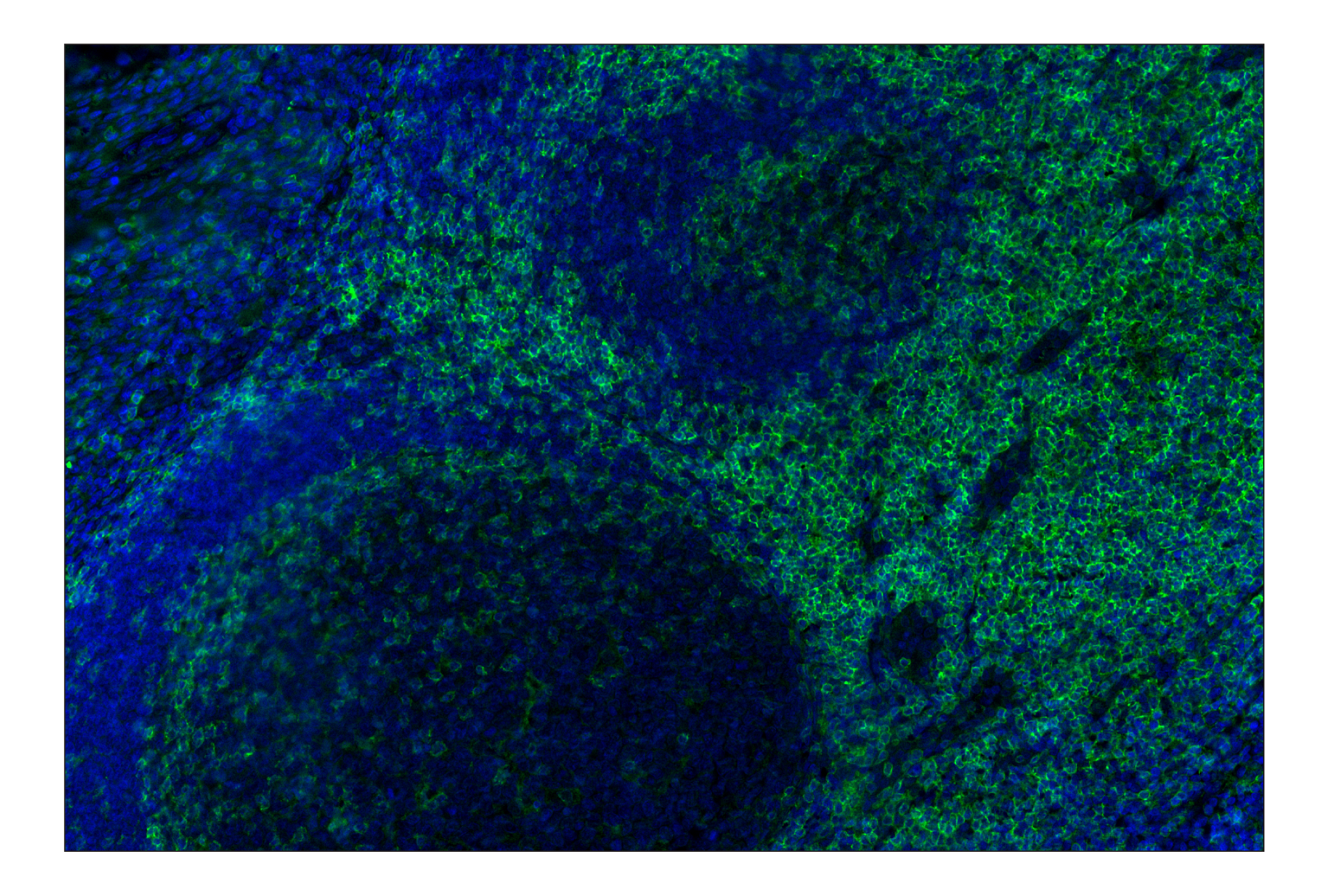 Immunohistochemistry Image 1: CD4 (MSVA-004R) Rabbit mAb (Alexa Fluor® 488 Conjugate)