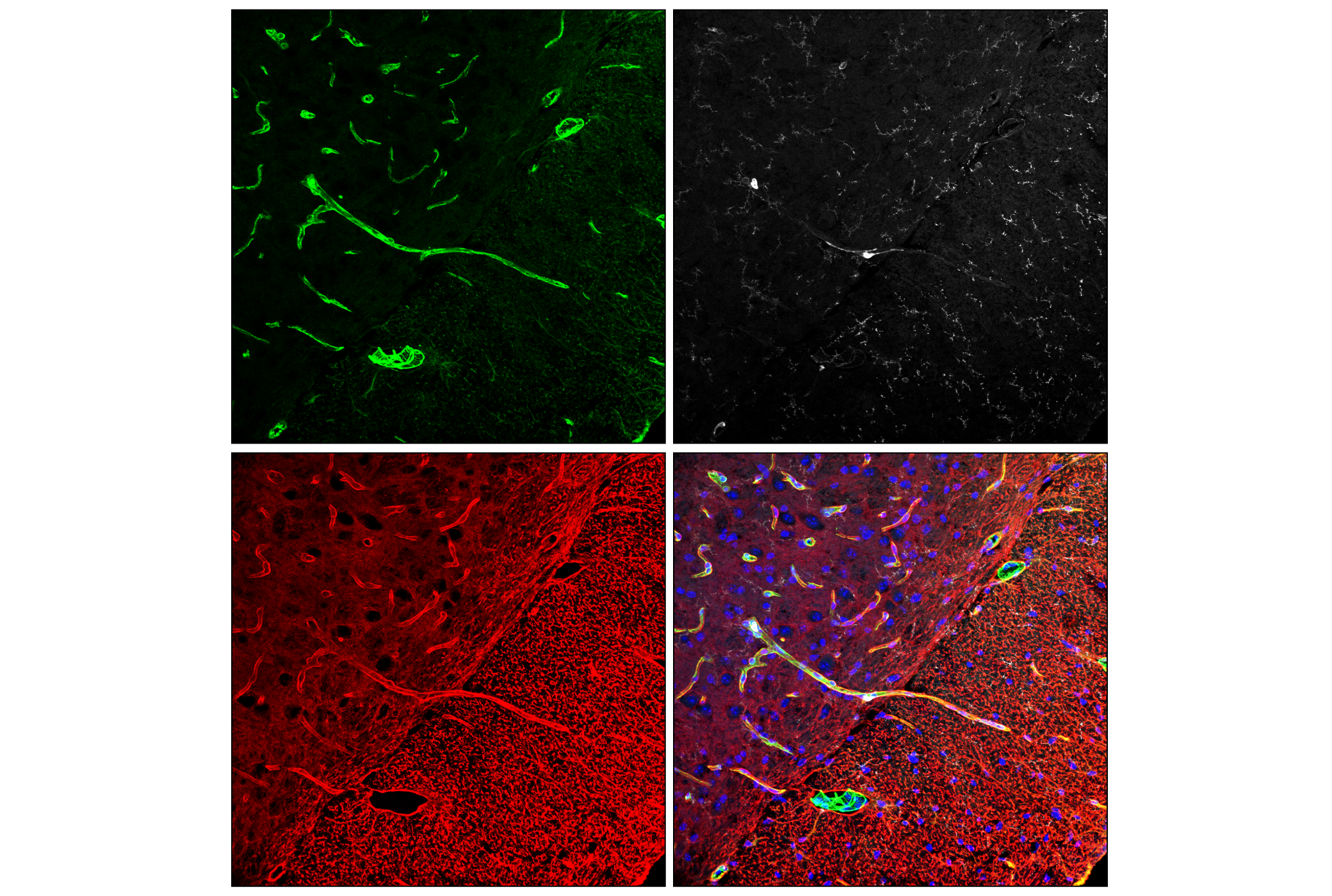 Immunofluorescence Image 3: Filamin A (E8P8M) Rabbit mAb (BSA and Azide Free)
