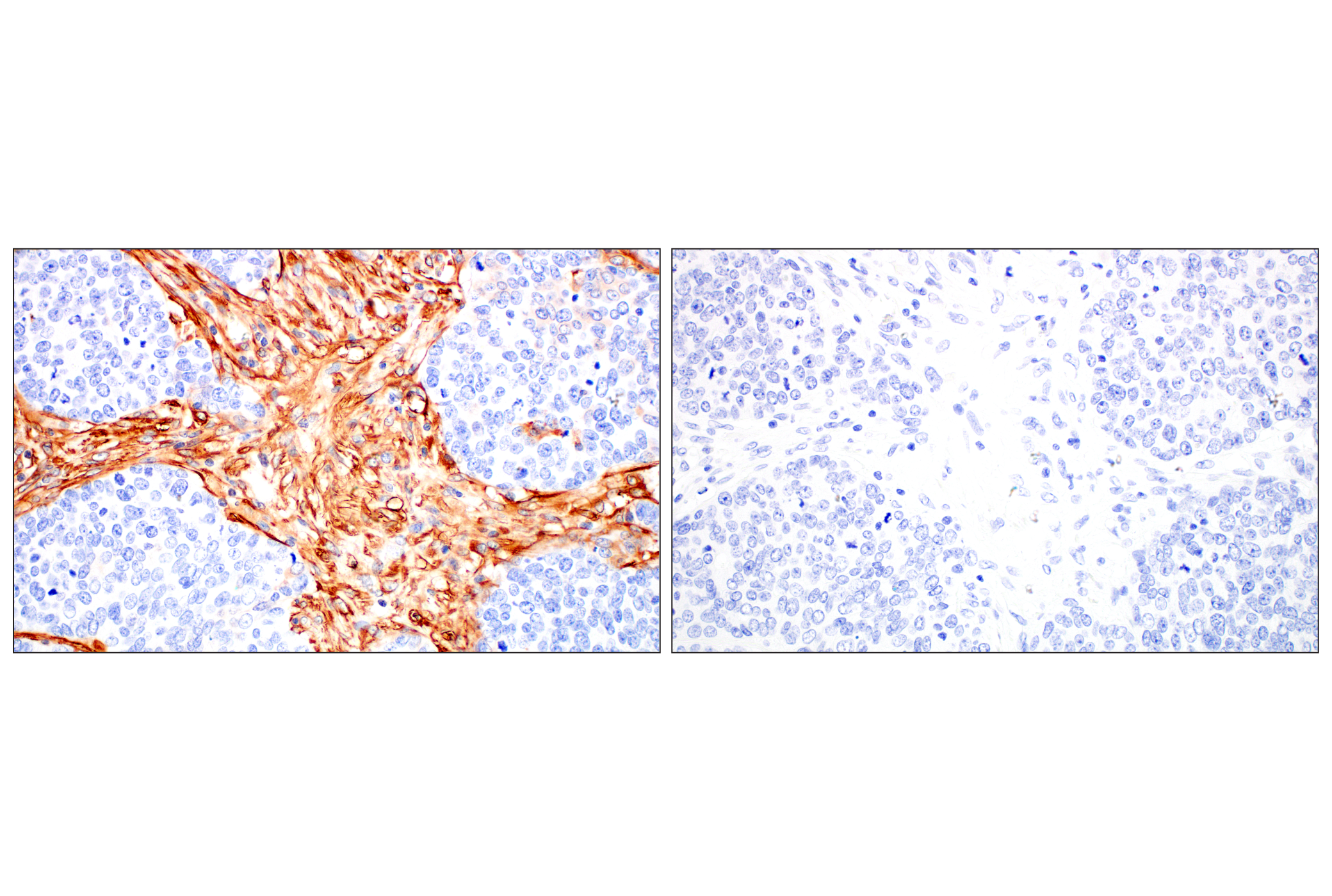 Immunohistochemistry Image 13: Filamin A (E8P8M) Rabbit mAb (BSA and Azide Free)