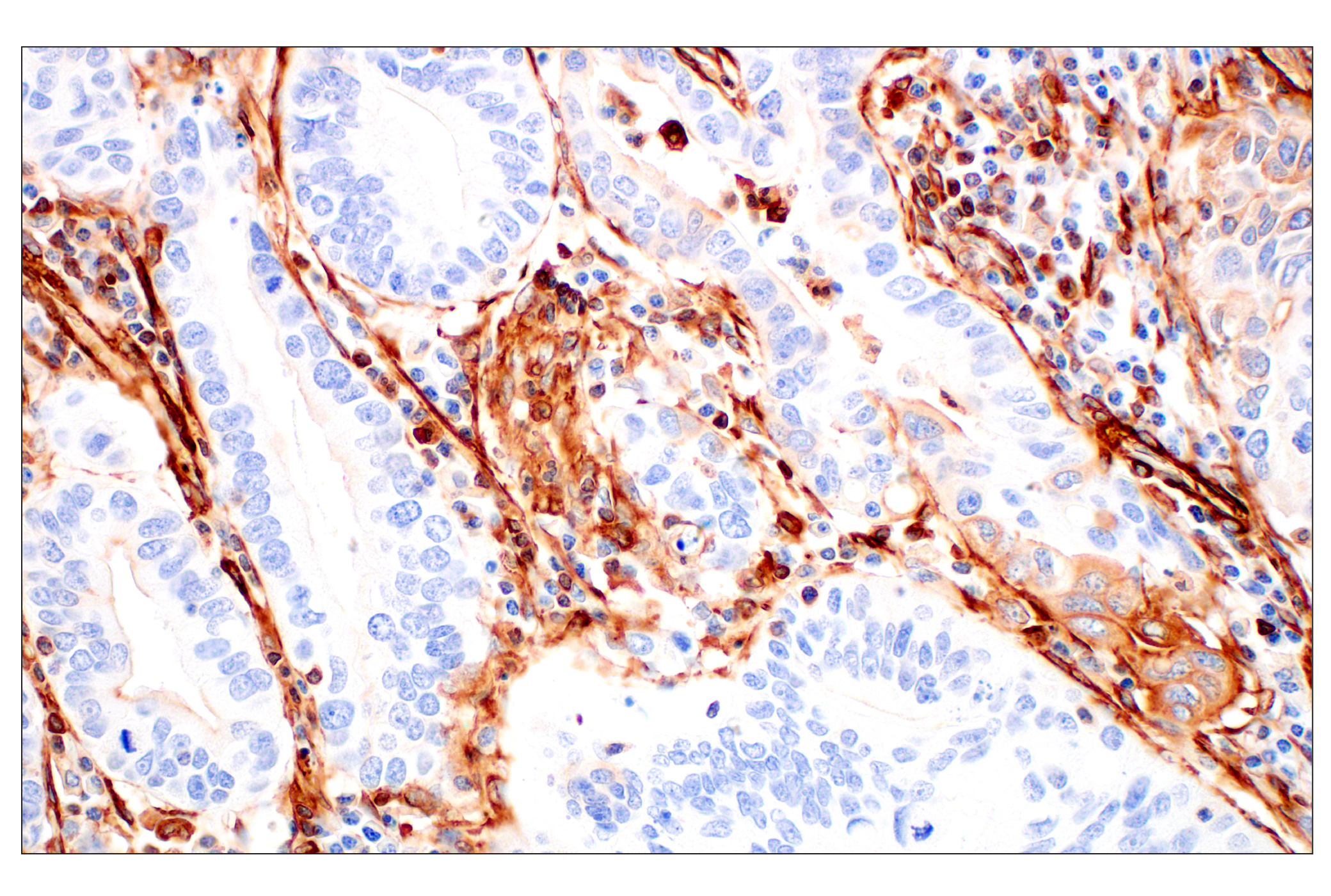 Immunohistochemistry Image 1: Filamin A (E8P8M) Rabbit mAb (BSA and Azide Free)