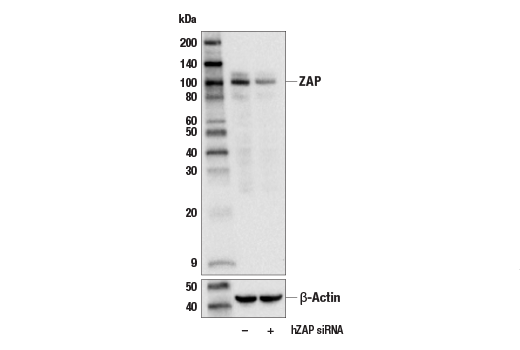 Western Blotting Image 1: ZAP Antibody