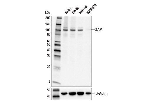 Western Blotting Image 2: ZAP Antibody