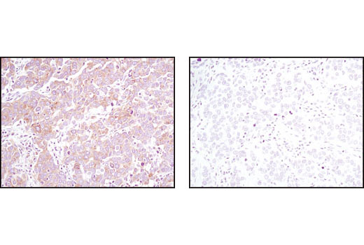 Immunohistochemistry Image 2: Pyruvate Dehydrogenase (C54G1) Rabbit mAb (BSA and Azide Free)