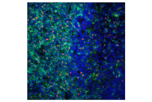 Immunofluorescence Image 1: FoxP3 (D6O8R) Rabbit mAb (BSA and Azide Free)