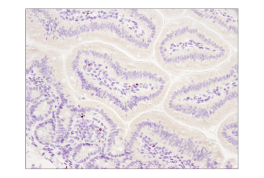 Immunohistochemistry Image 4: FoxP3 (D6O8R) Rabbit mAb (BSA and Azide Free)