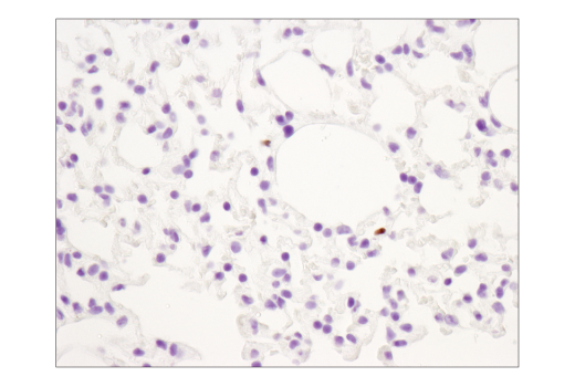 Immunohistochemistry Image 5: FoxP3 (D6O8R) Rabbit mAb (BSA and Azide Free)