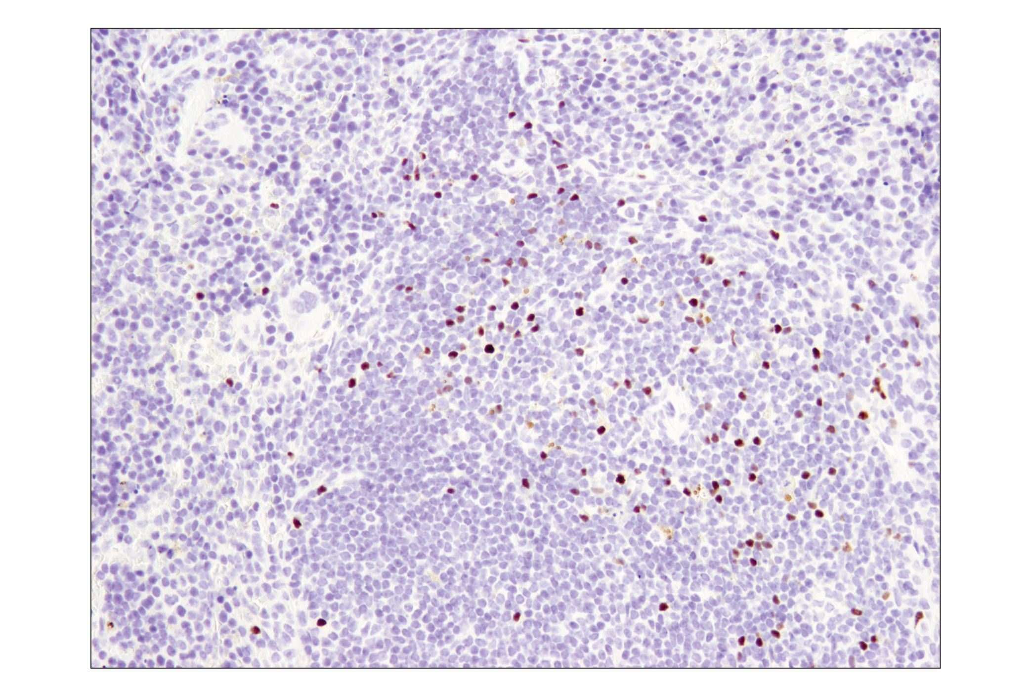 Immunohistochemistry Image 3: FoxP3 (D6O8R) Rabbit mAb (BSA and Azide Free)