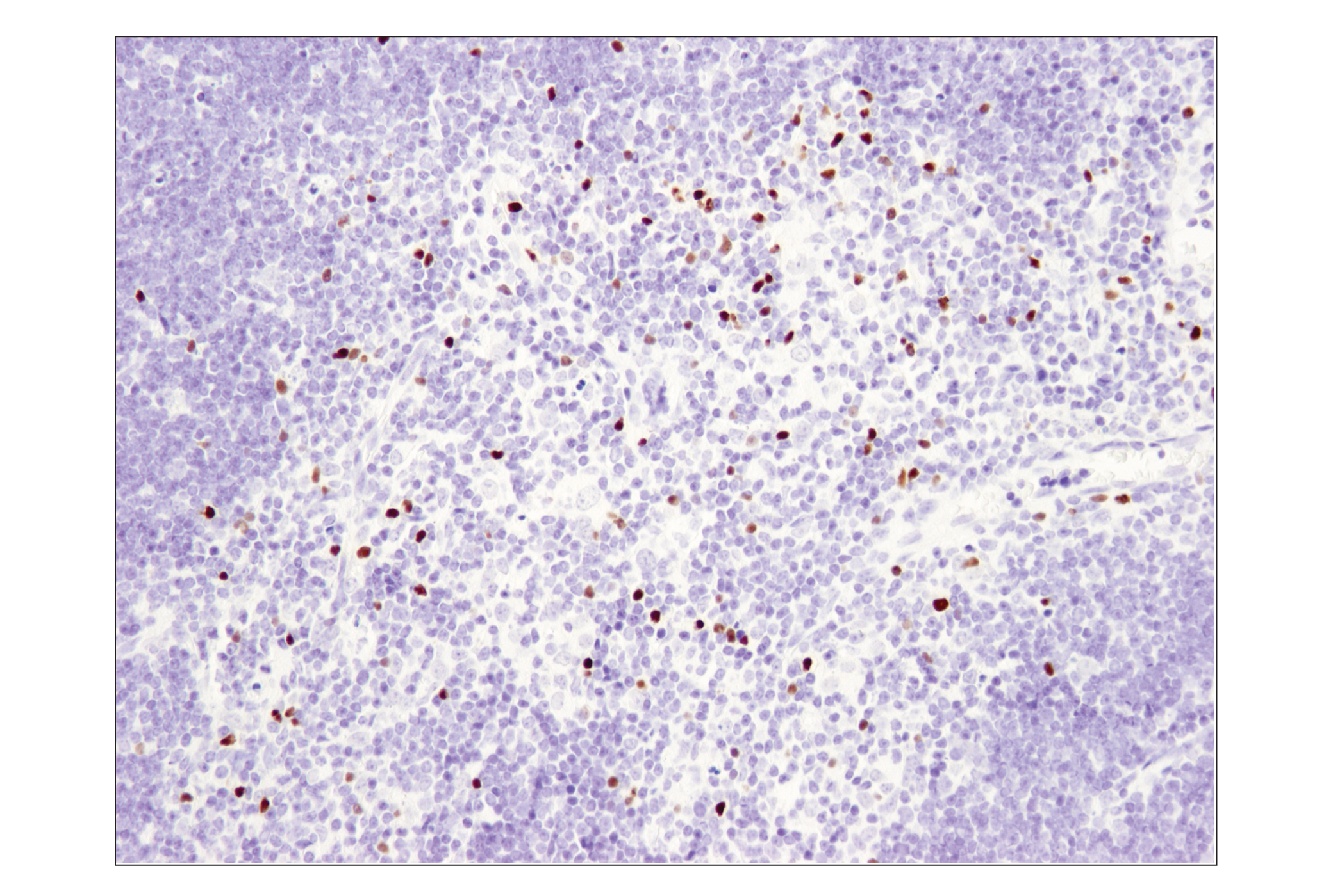 Immunohistochemistry Image 2: FoxP3 (D6O8R) Rabbit mAb (BSA and Azide Free)
