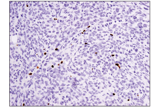 Immunohistochemistry Image 1: FoxP3 (D6O8R) Rabbit mAb (BSA and Azide Free)