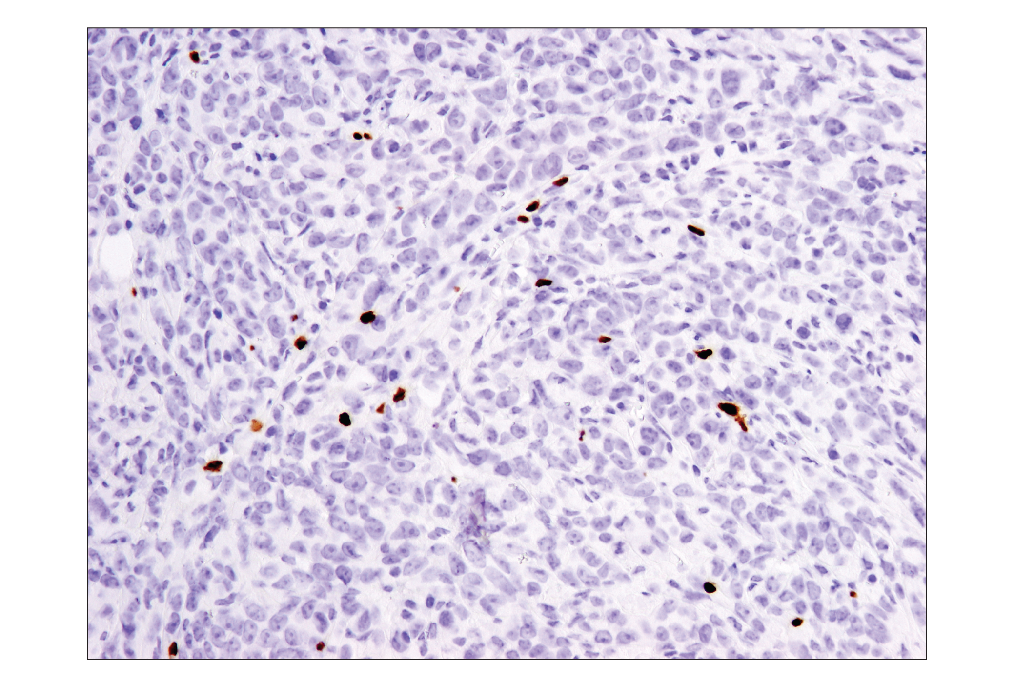 Immunohistochemistry Image 1: FoxP3 (D6O8R) Rabbit mAb (BSA and Azide Free)